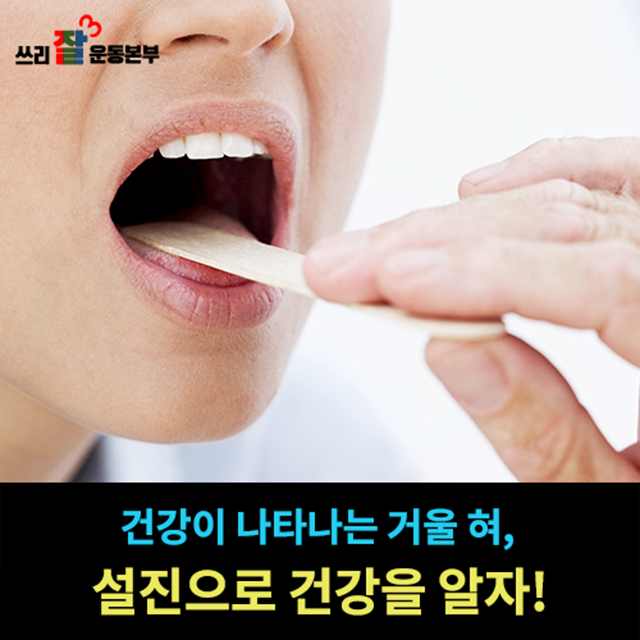[송대욱의 건강 쓰리잘](18) 건강이 나타나는 거울 혀, 설진으로 건강을 알자